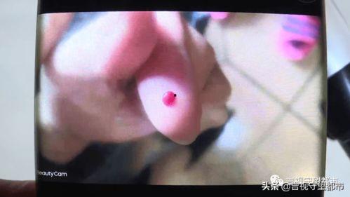 一滴血检测视频,未来医疗的便捷利器